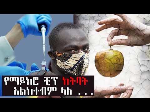 ቪዲዮ: ራሰ በራ ፊት የሆርኔት ንክሻን እንዴት ማከም ይቻላል?