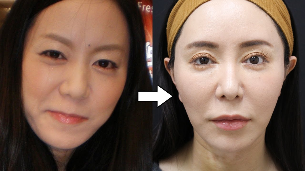 【二重整形など合計8回】