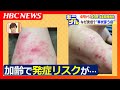 加齢とともに発症リスクが高まる 帯状ほう疹 針に刺されたような痛みや後遺症も 4月からスタートする65歳以上が対象の予防ワクチンの定期接種がキニナル 加齢とともに発症リスクが高まる 帯状ほう疹 針に刺されたような痛みや後遺症も 4月からスタートする65歳以上が対象の予防ワクチンの定期接種がキニナル