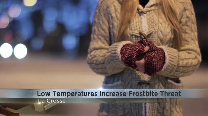 Healthcare officials warn frostbite can set in quickly during winter months