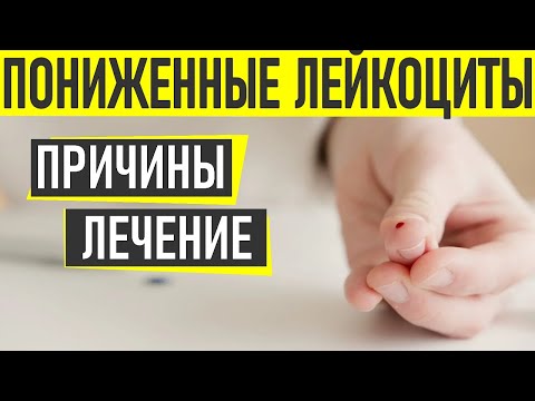 ЛЕЙКОЦИТЫ КРОВИ | Почему уровень лейкоцитов в крови понижен и что с этим делать