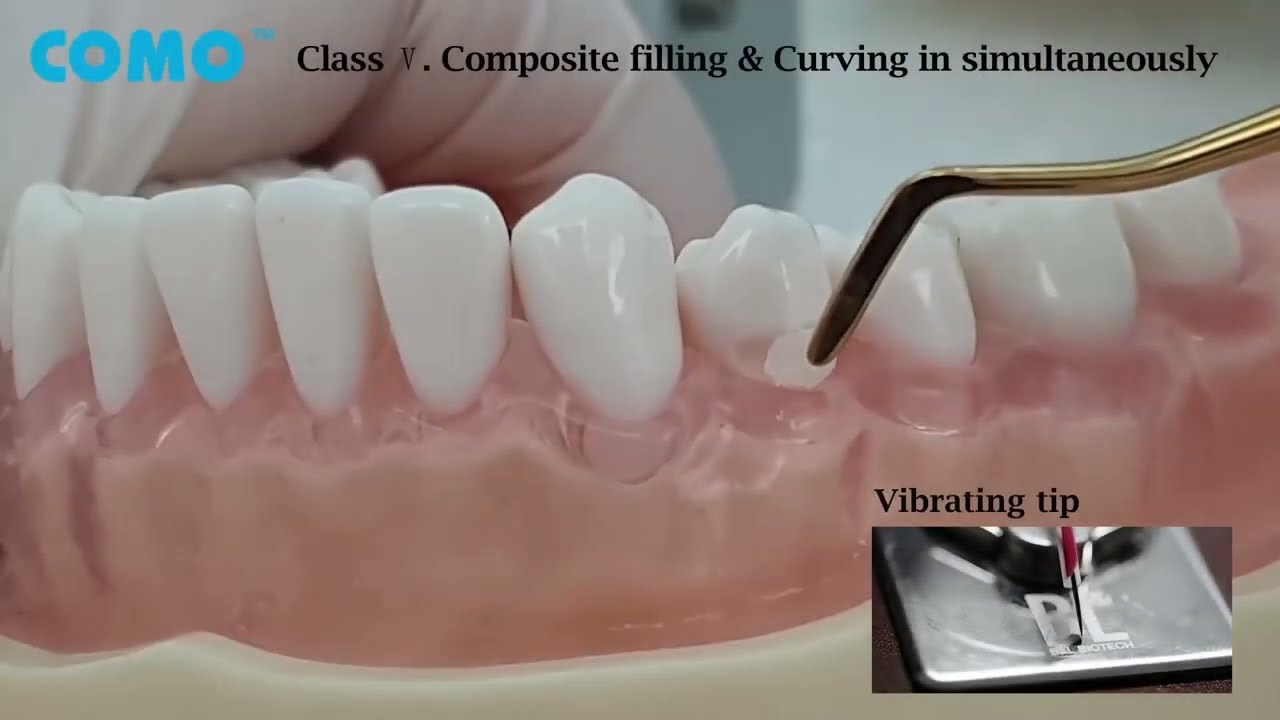 Use This To Do Fillings Faster And Better.