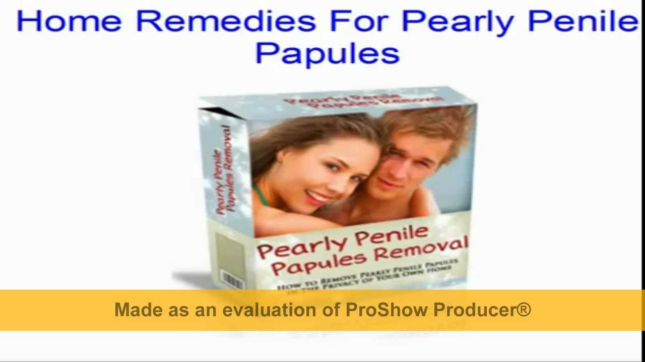 Treatment cream papules penile Pearly penile