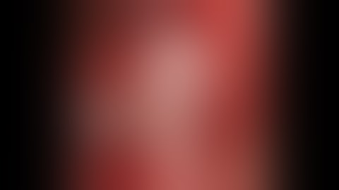 Arista AH in a hip revison