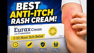 Best Anti-Itch Rash Cream? | Eurax Cream Review for Itchy Skin, Eczema, Rashes & Insect Bites