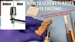 How to Cement TiBases to Zirconia Crowns  Using MicroEtchers and Resin Cement