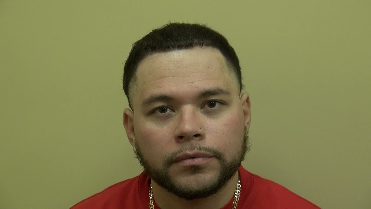 Rebuilding Whole Hairline by Dr. John Diep