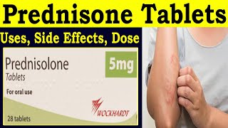 Prednisone 5 mg Tablet - Prednisone 20 mg Tablet - Uses, Side Effects, Dose