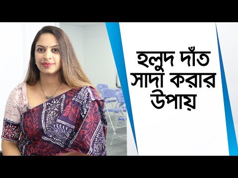 ভিডিও: কিভাবে মাড়ি থেকে দাঁতের আঠালো অপসারণ: 10 ধাপ