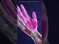 Carpal Tunnel Release Surgery (3D Animation)#carpaltunnel
