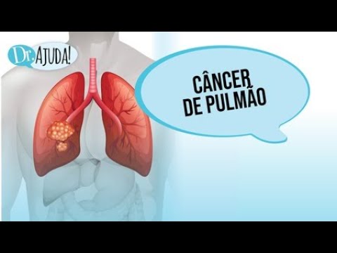 CÂNCER DE PULMÃO