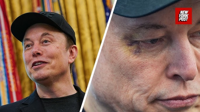 Elon Musk reveals who punched him in the face, leaving him with a shiner -  YouTube