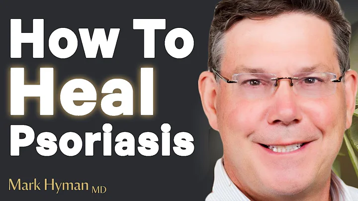 DO THIS To Heal Your Psoriasis TODAY! | Dr. Todd LePine & Mark Hyman - DayDayNews