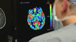 HealthWatch: Immunotherapy targets brain cancer