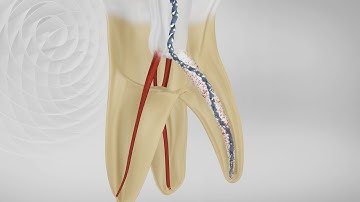 FKG XP-endo Shaper - English