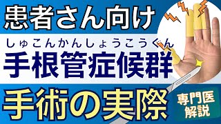 【患者さん用】手根管症候群　手術治療の実際　ー手専門医の解説ー