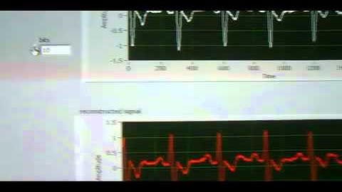 NIYANTRA 2012-PERFORMANCE COMPARISION OF VARIOUS COMPRESSION TECHNIQUES OF ECG SIGNAL