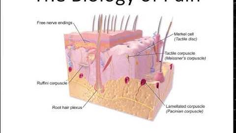Work comp: When does chronic pain begin?
