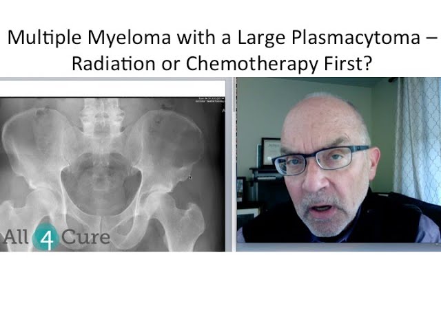 Radiation or Chemotherapy?