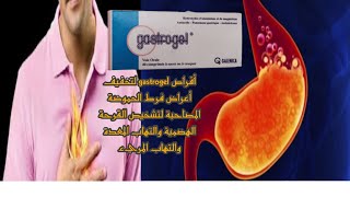 أقراص gastrogel لتخفيف أعراض فرط الحموضة, والتهاب المعدة والمريء