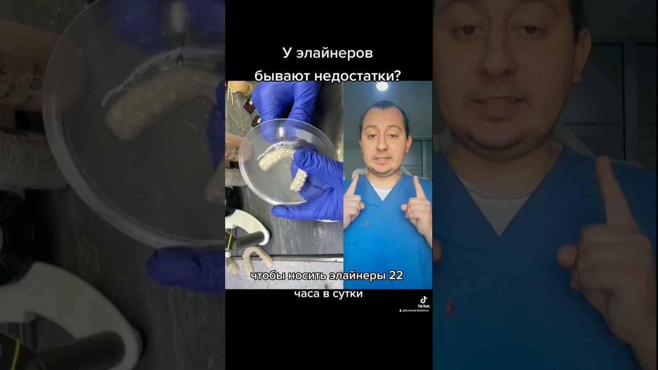 Недостатки элайнеров #стоматология #стоматолог #элайнеры #брекети # ...