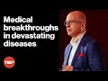 Can we stop MS and ALS? | Michael C. Levin | TEDxUniversityofSaskatchewan