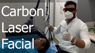 Carbon Laser Facial For Fair Flawless Skin Skinaa Clinic