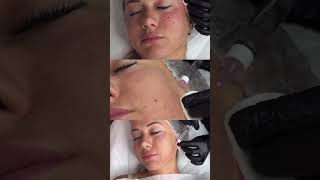 #контурнаяпластика #skincare #эстетическая #makeup #уходзажирнойкожей #beauty #красотаназдоровье