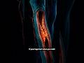 4 PAD Warning Signs Over 65 Most People Mistake For Arthritis #energy #science #neuroscience