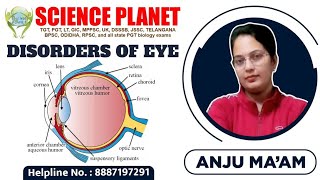 Disorders Of Eye Ii Explain-By Anju Mam Ii Science Planet