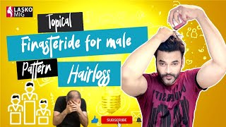 Male Pattern Baldness Treatment