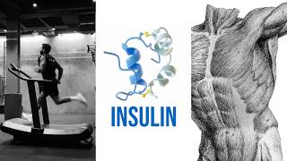 How to Improve Your Insulin Sensitivity