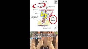 Nang tóc teo có bình thường không? Hair follicle shrinks down: is not normal?