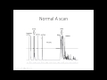 Ophthalmic ultrasound part 1