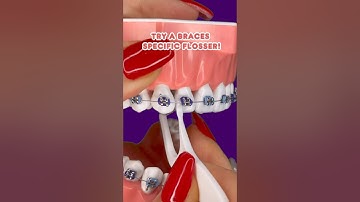 EASY way to FLOSS with BRACES ON 🤯 #braces #education #teeth