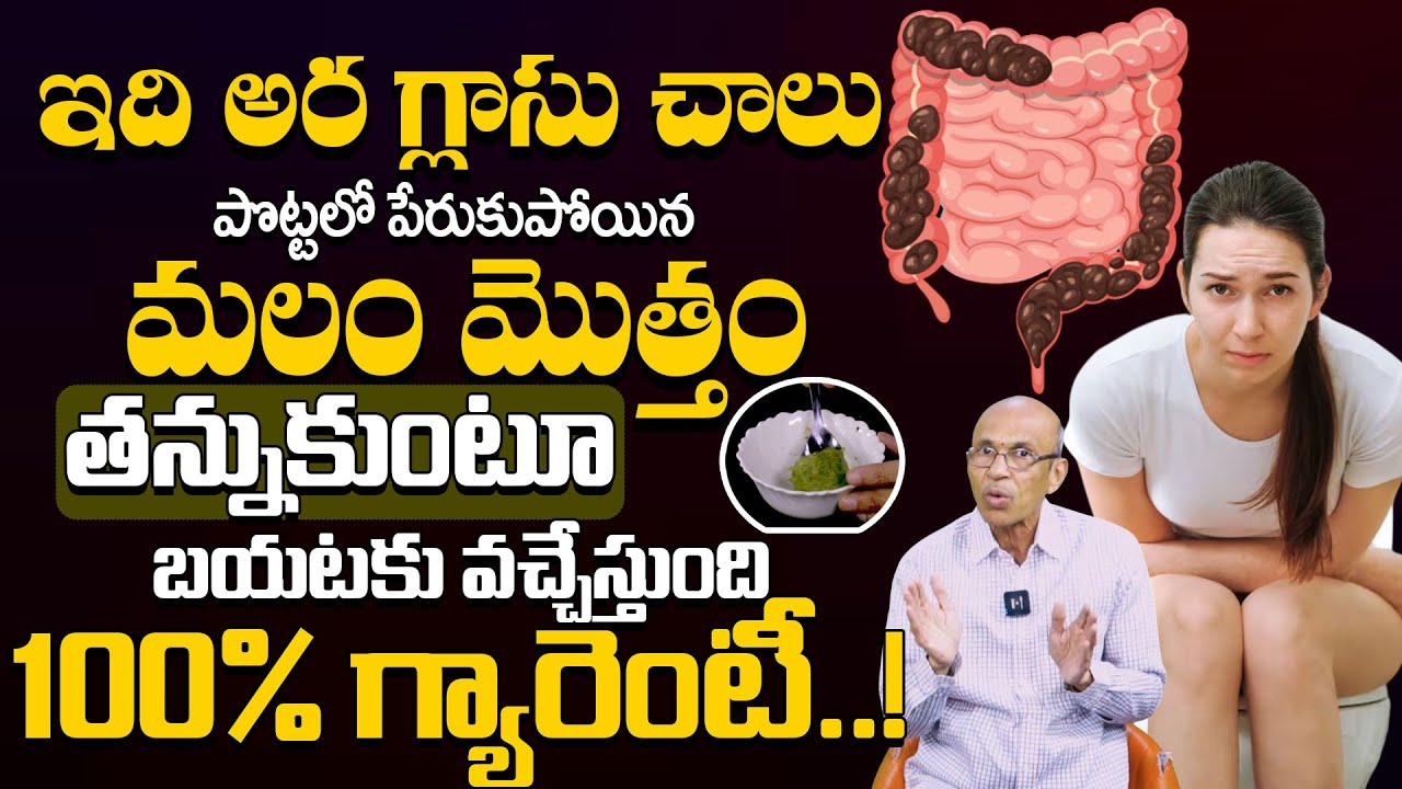 మలబద్ధకం పోయి మోషన్ ఫ్రీ అవ్వాలంటే | Free Motion Tips | Home remedy for Constipation | 