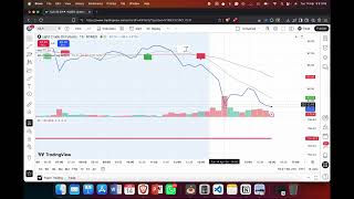 How To Zoom In On Tradingview Charts Increase Candle Size And Scale 2026