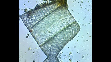 Isthmia focus stacking