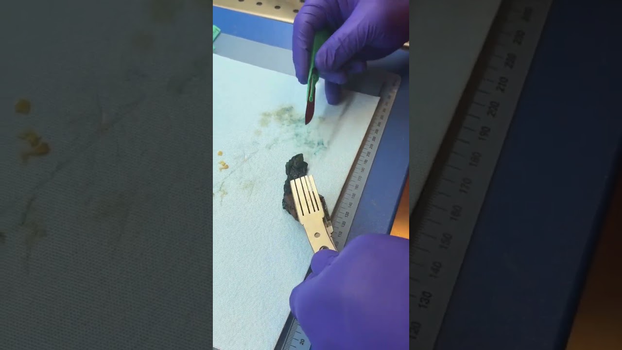 Grossing in Histology