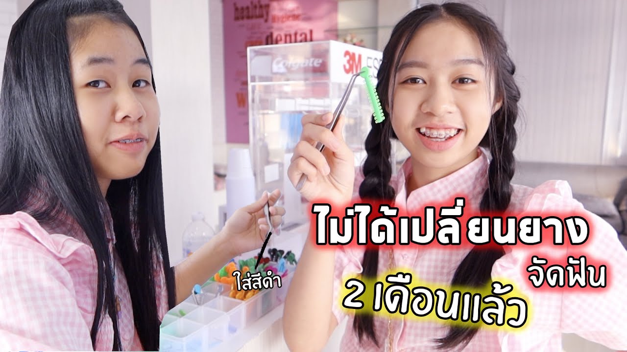 ไม่ได้เปลี่ยนยางจัดฟันสองเดือน‼️ จะเป็นไรมั้ย | WiwaWawow TV