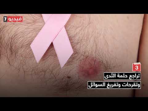 فيديو: كيفية تشخيص سرطان الثدي عند الرجال: 9 خطوات (بالصور)