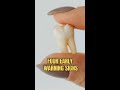 4 Early Signs of a Cracked Tooth You Should Not Ignore #shorts
