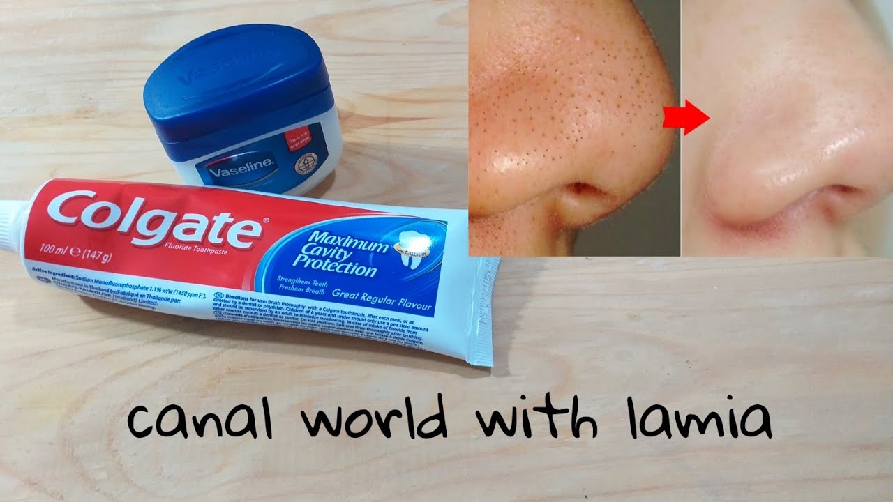 HOW TO GET RID OF BLACKHEADS VASELINE AND TOOTHPASTE COLGATE CLEAR SKIN TIPS AND TRICKS YouTube
