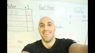 Foot Drop - A Diagnostic Approach