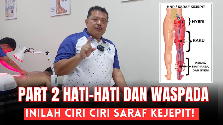 MCO ARIF -  PART 2 HATI-HATI DAN WASPADA, INILAH CIRI CIRI SARAF KEJEPIT!