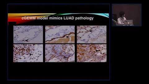 In vivo genome editing in cancer modeling and screening