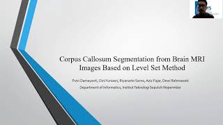 1570645092 - Corpus Callosum Segmentation from Brain MRI Images Based on Level Set Method
