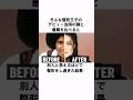 「30年間で100回数の整形」マイケルジャクソンについての雑学 #shorts #雑学 #豆知識