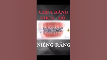 Chữa Răng Hô, Răng Thưa Khi Niềng Răng
