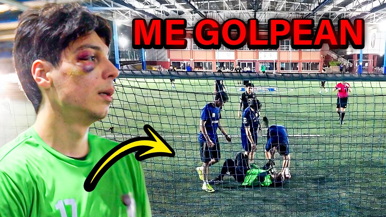 CREO MI PROPIO EQUIPO DE FÚTBOL Y ME GOLPEAN EN LA CARA POR ESTA JUGADA... - Yair17
